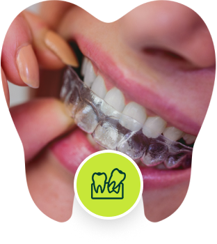 Dental Aligners (Invisalign)