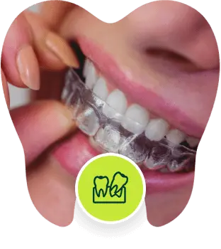 Dental Aligners (Invisalign)