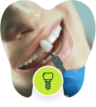 Dental Implants