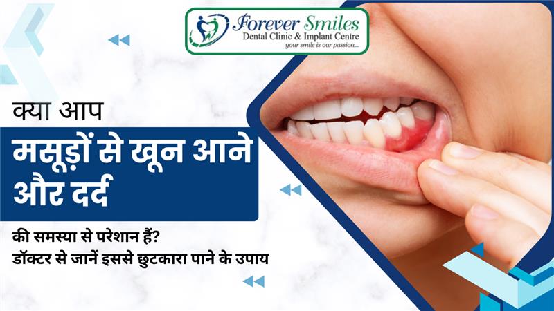मसूड़ों से खून आने और दर्द की समस्या