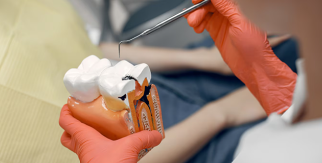 Root canal treatment
