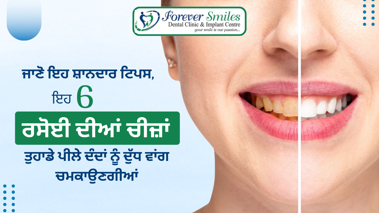 Home remedies to whiten yellow teeth – Forever Smiles Dental Clinic tips