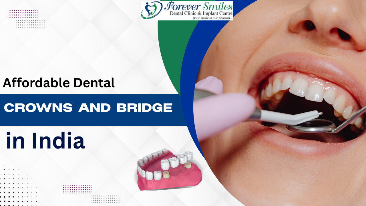 Affordable dental crowns and bridges in India at Forever Smiles Dental Clinic for restoring healthy and beautiful smiles.