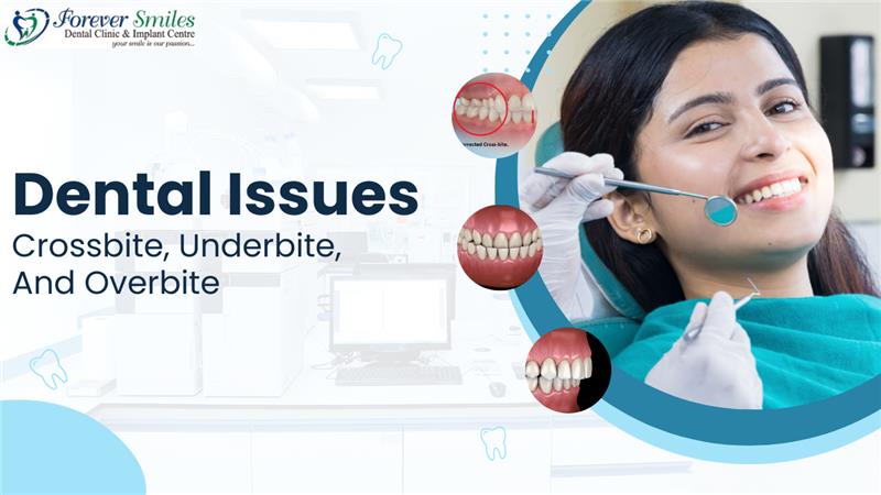 Dental issues like crossbite, underbite, and overbite explained at Forever Smiles Clinic