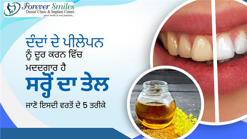 Mustard oil for teeth whitening – natural remedy to reduce yellow stains and improve dental health.