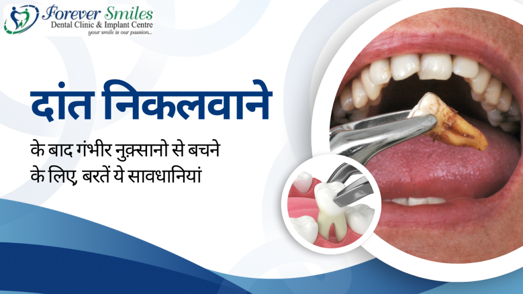 Tooth extraction precautions to avoid complications at Forever Smiles Clinic.