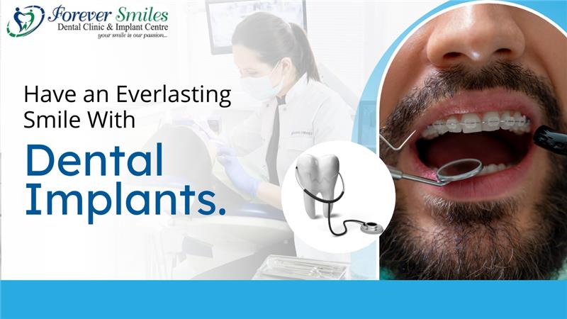 Dental implants for a lasting smile at Forever Smiles Clinic
