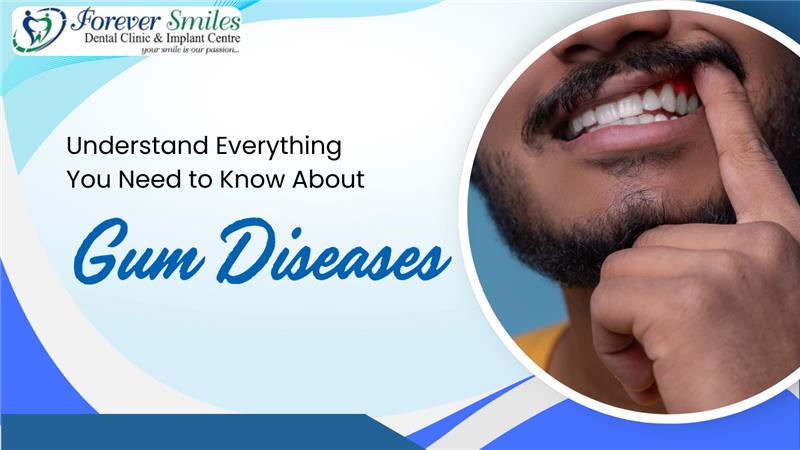 Forever Smiles Dental Clinic banner about gum diseases – man showing red swollen gums with dental care awareness message.